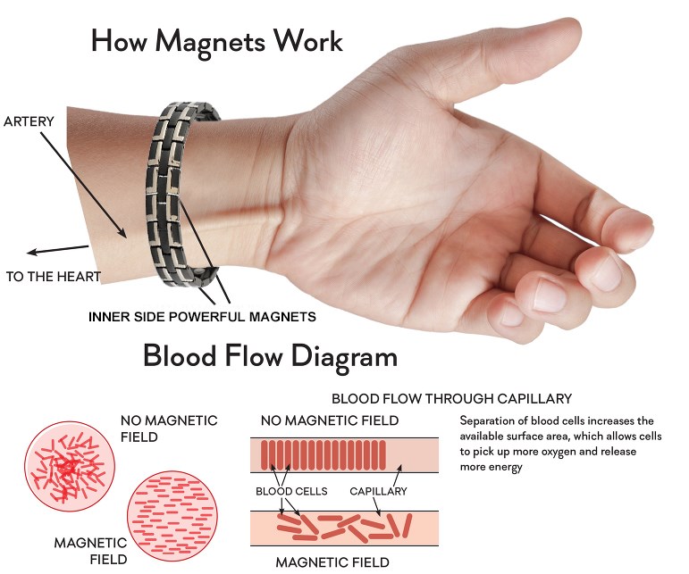 magnetic bracelet