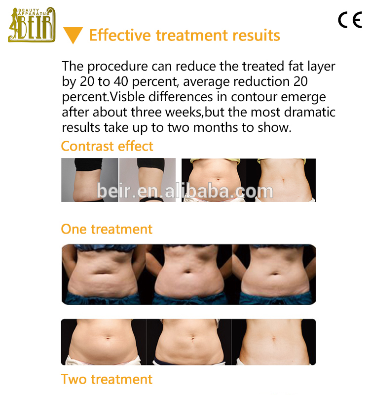 Freezing Fat salon beauty machine from China Manufacturer - Guangzhou ...