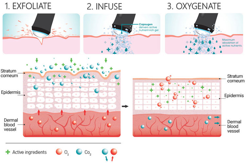 CO2 oxygen 10.jpg