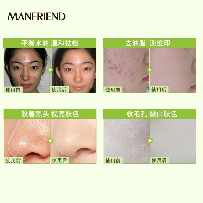 Hf993079fcda9420f81507a155779858cm.jpg