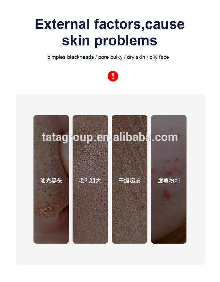 OEM ODM Private Label Oil Control Firming Hyaluronic Acid Hydrating Moisturizing Facial Face Toner Spray For Men