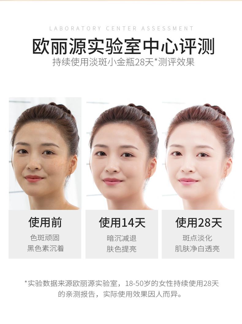 OEM ODM Beauty Anti Freckle Treatment Removal Cream Freckle Whitening Cream