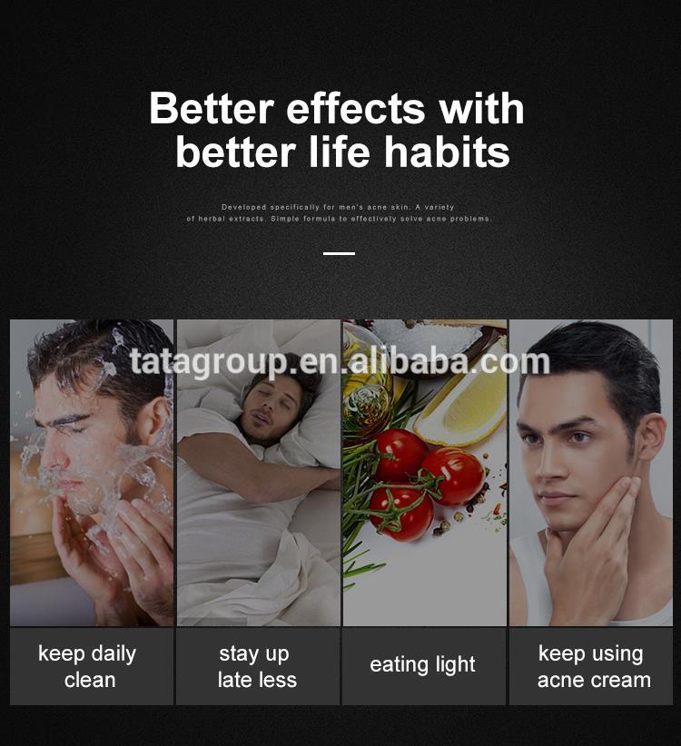 Custom Logo Private Label Remove Acne Pimples Herbal Anti-acne Cream