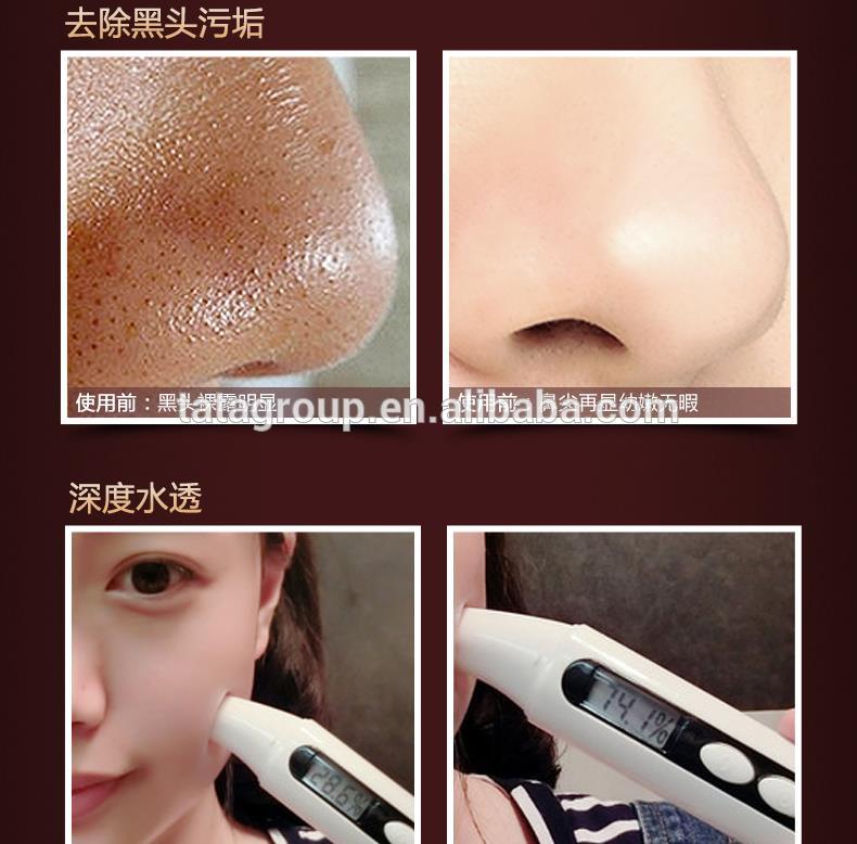 Wholesale Face Skin Care Cleansing Blackhead Private Label Black Peel Off Mask