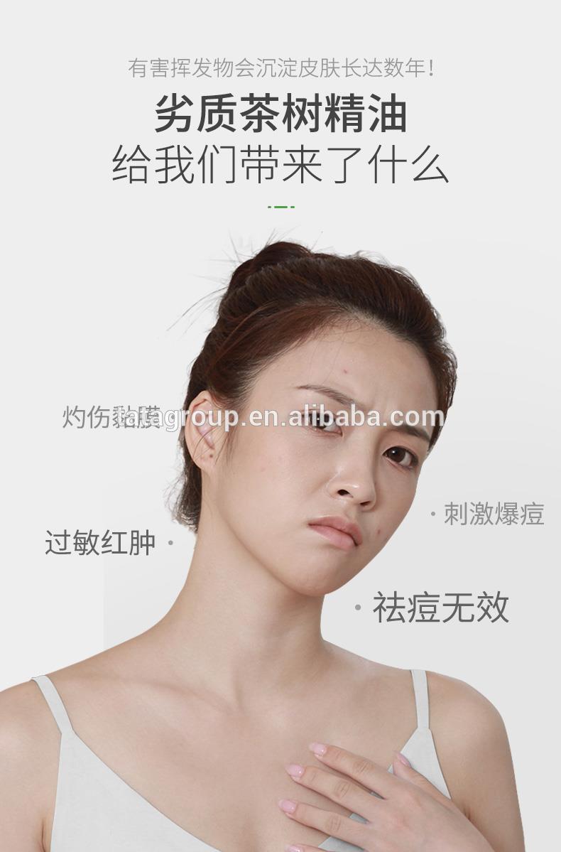 Wholesale Oem Private Label Custom Anti Acne Oil Control Pure Tea Tree Essential Oil