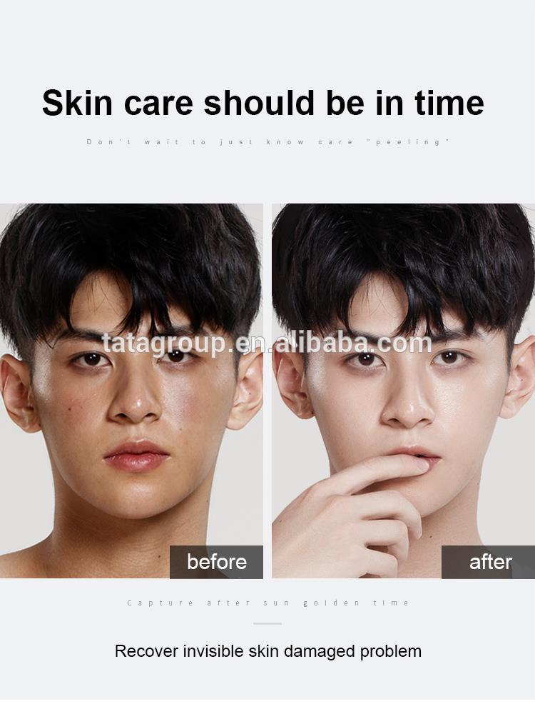 OEM ODM Custom Private Label Sun Damaged Skin Repair Moisturizing Cream After Sun Cooling Best Soothing Gel