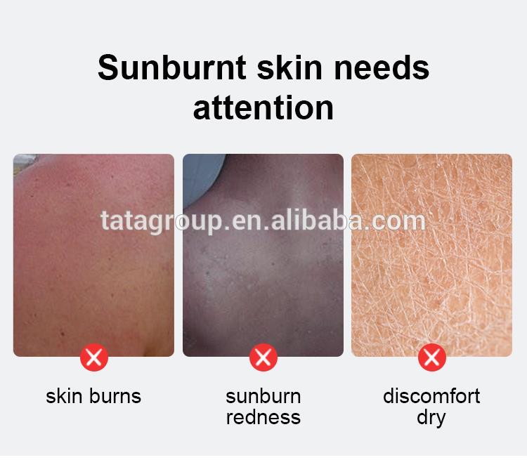 OEM ODM Custom Private Label Sun Damaged Skin Repair Moisturizing Cream After Sun Cooling Best Soothing Gel