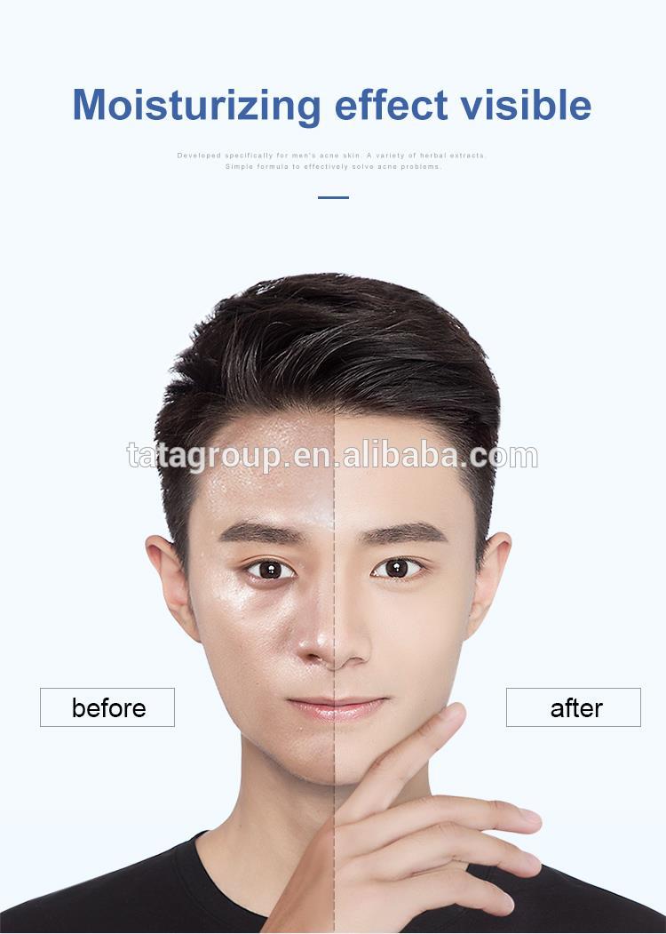 Men Daily Best SkinCare Moist Moisturizer Face Cream Lotion For Dry Skin