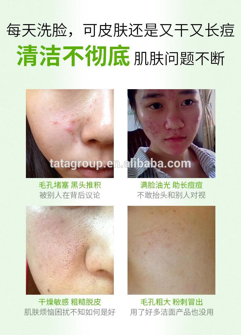 Best Private Label Beauty Skincare Anti Acne Green Mung Bean Face Mud Mask Clay Mask