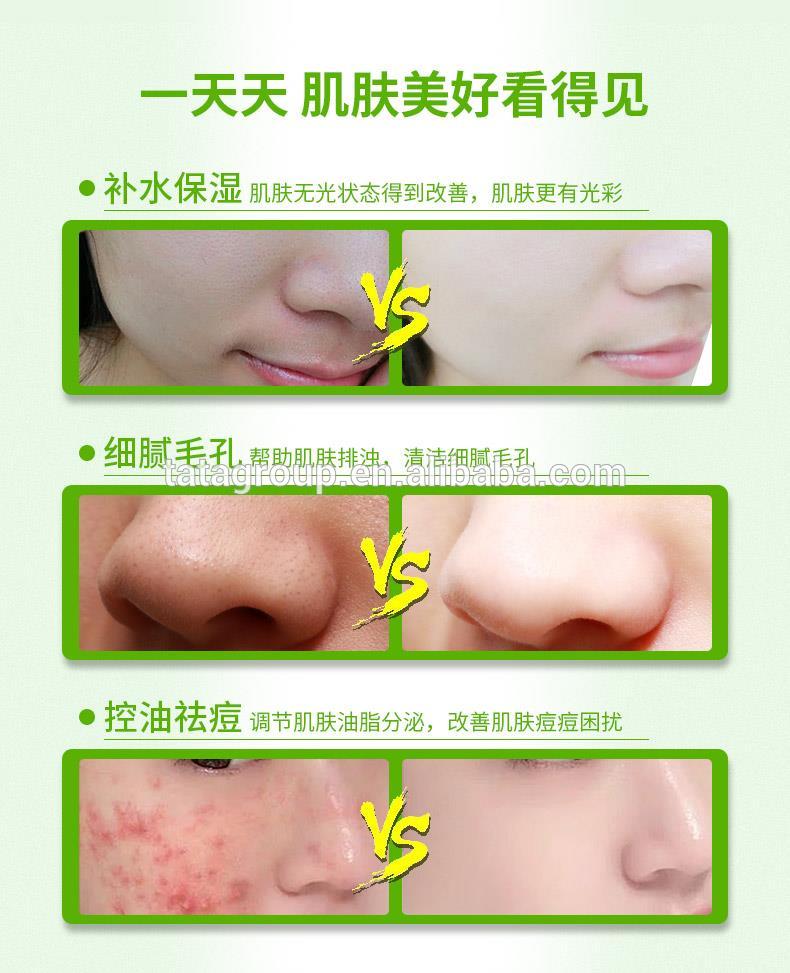 Best Private Label Beauty Skincare Anti Acne Green Mung Bean Face Mud Mask Clay Mask