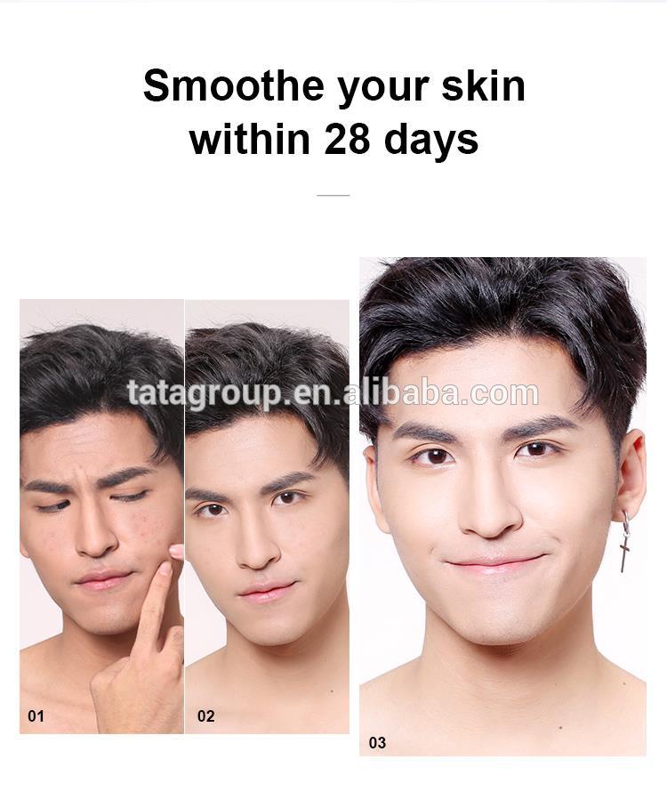 China Wholesale Bulk Cosmetic Beauty Acne Removal Face Anti Acne Mask For Acne