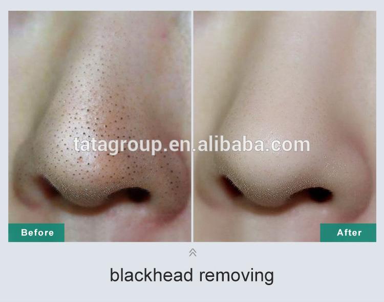 Private Label Facial Oil Control Anti Acne Cleanser