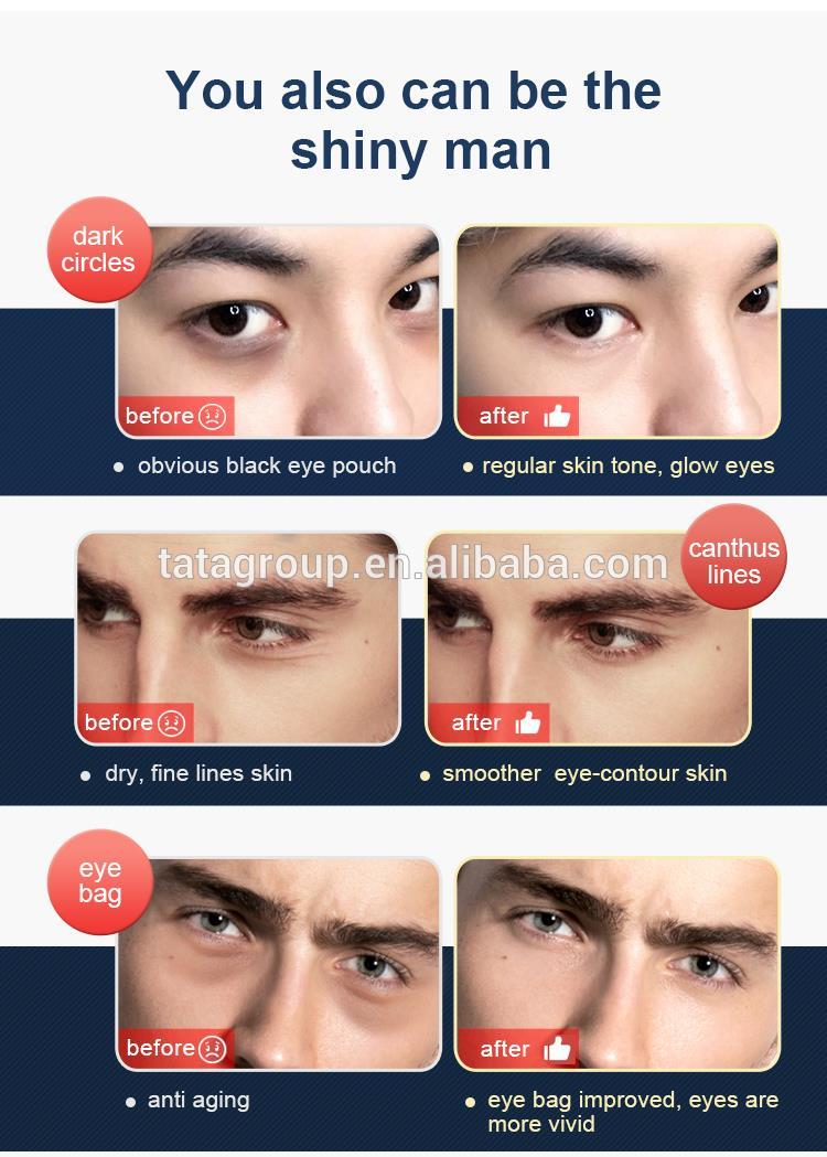 Best Private Label Men Roll ON Anti Aging Wrinkle Instant Eye Bag Remova Eye Cream For Men Dark Circle Remove