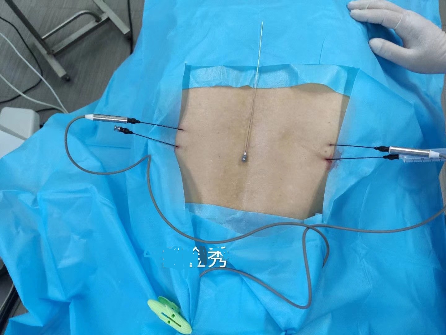 RF Electrode probe-2.jpg