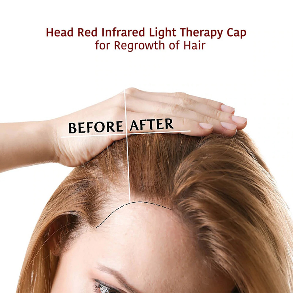 Led Light Therapy Hat