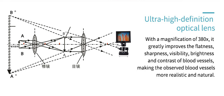 Microcirculation Microscope Blood Analysis