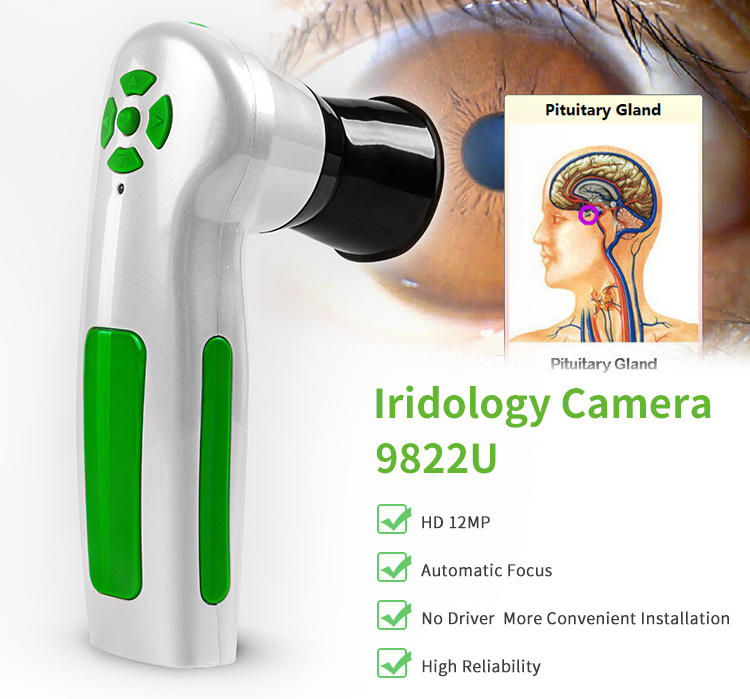 Iris Analyzer