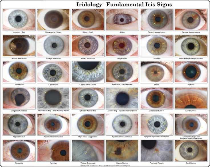 Iris Analyzer