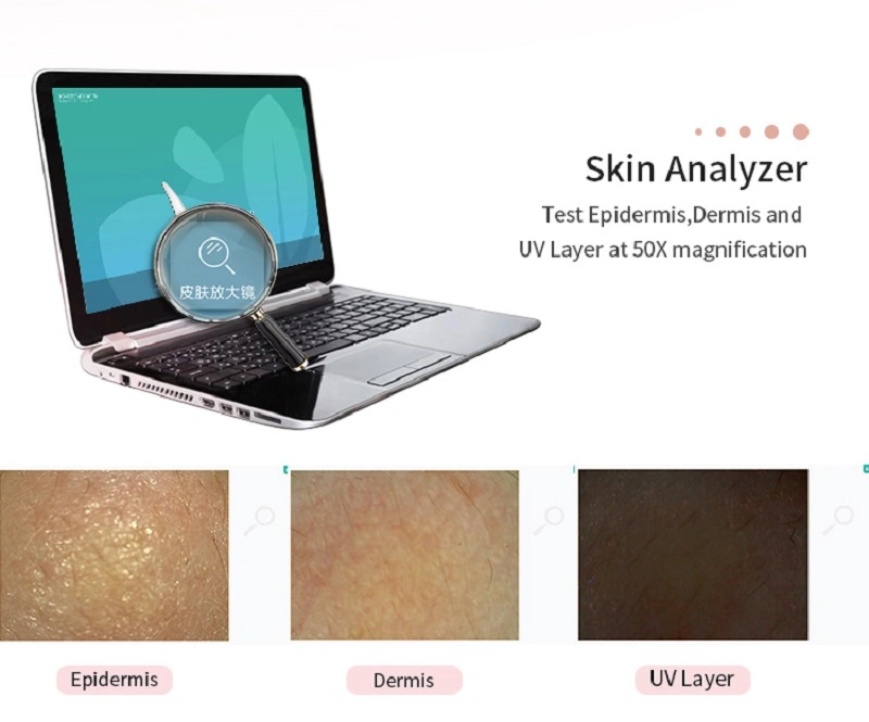 Skin Analyzer