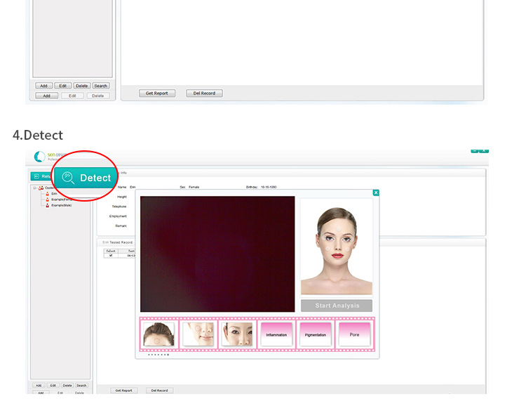 Skin Analyzer
